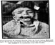 Hayriye Han?m who was raped by Greek soldiers and had a bomb exploded in her mouth at Yalova (1921) 462x732 from melike ipek yalova sexs