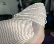 Please for the love of Christ do NOT stick your foot under the net. My opponent did, I have a fractured left toe and a 2nd degree right ankle sprain. from cutegirl sprain ankle