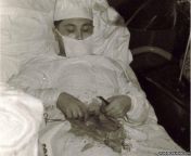Dr. Leonid Rogozov performing surgery on himself in 1967. While doing scientific research in Antarctica, Doc Rogozov had his appendix burst. With no surgeon nearby, he decided to handle the operation himself. In the end, the Doc recovered well and went on from choytli doc