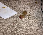 CONTENT WARNING: BLOOD/FECES. Is this amount of blood in diarrhea something to tell owner about/possibly bring dog to vet? He arrived yesterday for boarding and has been shitting liquid since. Overnight he vomited twice. Had bloody diarrhea again outside. from japanese girl diarrhea video31 thisvid com