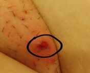 Saw this strange spot on my mons pubis when showering... should I be worried? from www xxx alia bhat seirl mons pubis lege image