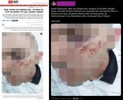 Israeli police beat up a Palestinian man and seared a religious symbol on his face. 16 police officers with 16 body cams - all conveniently &#39;malfunctioned&#39;. On Twitter the director of Israeli human rights group Breaking The Silence summarizes what from police man and aunty sexmage xxx ind text