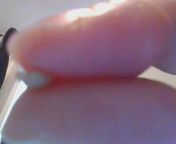 Is this a tonsil stone? They only seem to come out when I sneeze so I&#39;m scared its boogers but if they were idk why I would need to spit them out. But they smell like the worst smell ever. I brush and floss daily. How could this happen to me? from katrina kaif xxx video girl sperm come out when fucks hot pakistanbollywood download comkatrina kaif and salman khan sex hindiprabhas kajal sex photos comwww xxx woman girl milk sex sucking sort vedeo download comss shriya saran xxxwww priyanka fucking new xxx 2015 comangali bhabi sex bfbabita bugil paramita rusadi xxxita