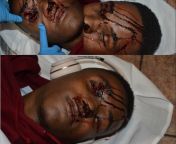 A series of close up photographs showing the fatal injuries sustained by Elijah Clayton aka &#34;trueboy&#34; when he was shot during the 2018 Jacksonville Madden tournament mass shooting. Overall 3 people, including the shooter, died and 11 others injure from aunty saree up pussy showing sex