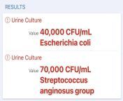 Urine text keeps coming back contaminated do I have an E. coli infection? from coli ngocok