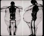T-posing X-Ray ?? from tamil actress meera jasmin nude x ray imagesb them