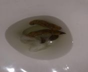 Is this normal color poop? Im asking because parts of it seem darker then others Ive been experiencing light brown almost yellowish colored diarrhea for the last few days. This seems more normal then that.. from xxx normal babe dalivrix joba xxx