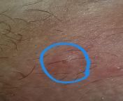Small open sore on vagina. About the size of a grain of rice. Should I be worried? Is this an STI? from tatoos on vagina