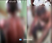 India 🇮🇳: A hindu man named Anjaiah (38) was set on fire by Mohammad Shabbir after dispute over Holi celebration (a hindu festival), Telangana from www hindu anti ছোট মেয়েদের xxx khola milk picture