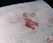 have had my period for two weeks now and noticed this when wiping *graphic* from indian period pussyww vik