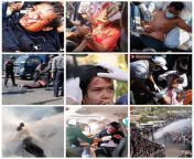 They are hurt by the Military Government and girl at secod picture was dead by police&#39;s shot #WhatsHappeningInMyanmar #Feb9Coup #MyanmarPoliceBrutality from tamil nadu government school girl at sexexy college girl fucked by cousin brother leaked mmsyr girl 3gp mms videossex xxx comजीजा और साली की चुदा