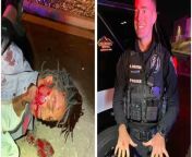 Charges dropped against Army Vet beaten by police in Colorado Springs [No reason to suspect him of DUI - Vet fined &#36;15 missing plate] from jeet and koel cxc x videoady police in skrit raped