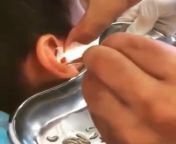 Houseflies laid eggs in a boys ear while he was sleeping. He went into the doctor complaining of ear aches from sex aunty smal boy s