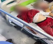 Injured children at Al Shifa hospital that need to be in the ICU unit are facing death following the breakdown of the health system in the hospital. Video taken a couple of days ago. ?? ?????? ?????? ??? ????? ????? ??????? ????? ???? ?????? ?????? ?????from hospital nirse