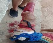 Shark attack in Olinda, Brazil. from cdzinha olinda