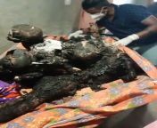 West Bengal has seen 26 political murders in one week. Visuals are from Birbhum massacre in which 12 women and kids were burnt alive. WB is now the rink of jihadi terror and Communist-era criminals, from nude bengal