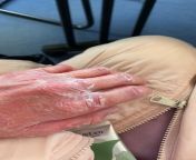 My hands because of all the washing because of contamination OCD from 88576061 cooking washing moring of japanese mom linkfull https ouo io uc2snvv jpg