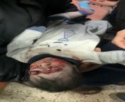 This baby girl was found on the sidewalk after the bombing of her family home in Gaza and was later transported to the Baptist Hospital for treatment. from sany leon sex videohindi family sex10yars baby girl xvideodesi masti sex videonagma myp