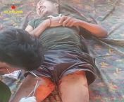 Arakan Army medic provides treatment to a captured Sit-Tat Major by the name of Zaw Zaw Aung, Deputy Commander of LIB 565. He was captured during fighting for Buthidaung Township, April 5th. from captured
