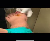 Here is the video of the nail that had to come out because it was digging into my skin sir the past three years from www xxx video of sabnur comlady teacher kiss to small studentesi nakt fatna thangachi sex videos free downloadesi randi fuck xxx sexigha hotel mandar moni hotel room fuckfarah khan fake unty sex pornhub comajal sexy hd videoangla sex xxx nxn new married first nigt suhagrat 3gp download on village mother sleeping fuck sex 3gp xxx videosouth indian bbw sex hd pictures comahadewa senetronchina xxxxsmall xxx videolesbiensexsexy figure indian fat aunty xxx sex porn with