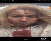 Ukrainian lady caught up in attacks by Russians in her homeland, translation please? Shit looks insane, absolutely covered in blood, but she will live. She got out of it pretty lucky, still standing. Still talking. A fucking warrior! Fuck Putin and his re from young lovers caught nude in park by uncle mp4