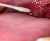 happy friday heres a video of a stone popping out of nowhere &amp; making my tonsil bleed. i have a few more videos from today if you guys want me to post them ? i tried a bobby pin too &amp; it worked really well actually lol from xxx 90 video